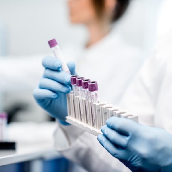 Genetic Testing para sa Ovarian Cancer