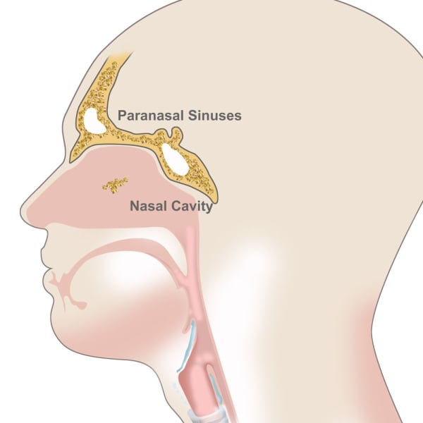 Paranasal Sinuses at Nasal Cavity